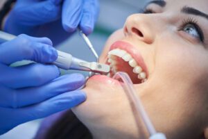 dental cleanings paso robles dental dentist in paso robles, ca