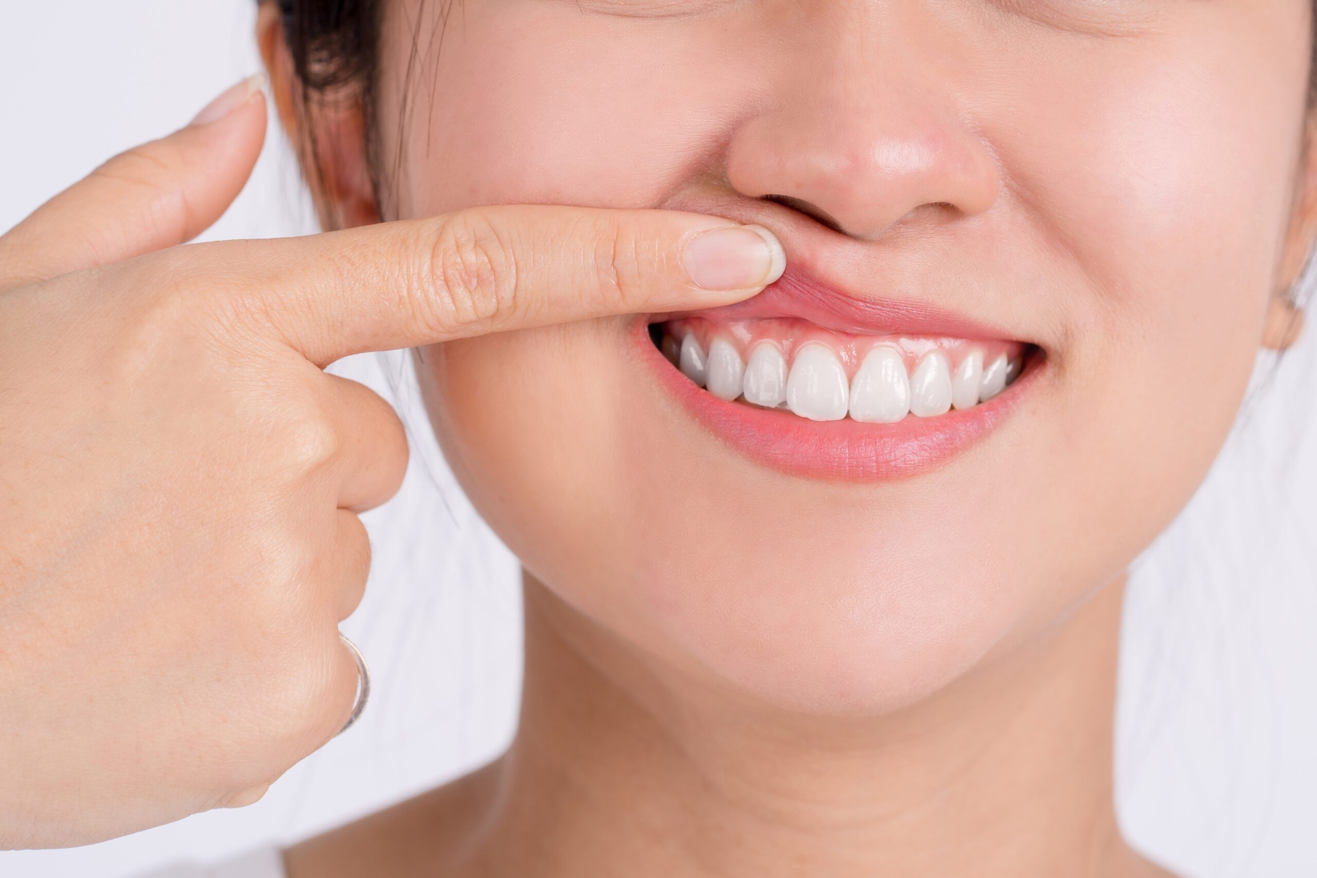 Gum disease treatment paso robles